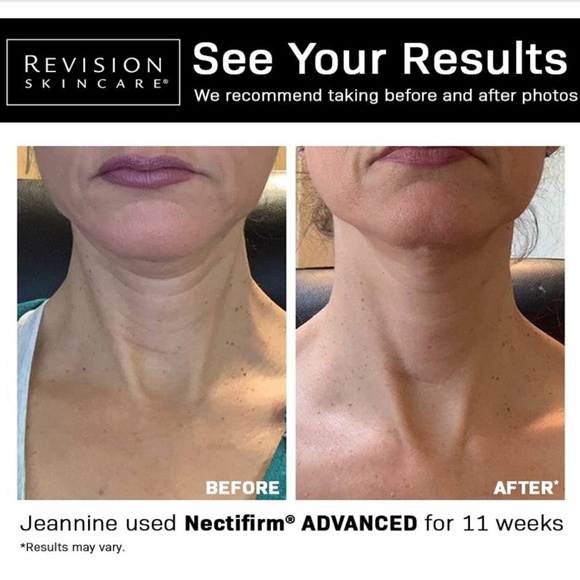 Revision Nectifirm Advanced NEW - Picture 2 of 3